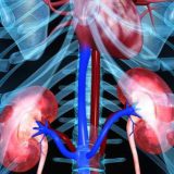 How Lifestyle Choices Affect Your Kidney Health