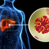The Disease That Kills 1.3 Million People Every Year